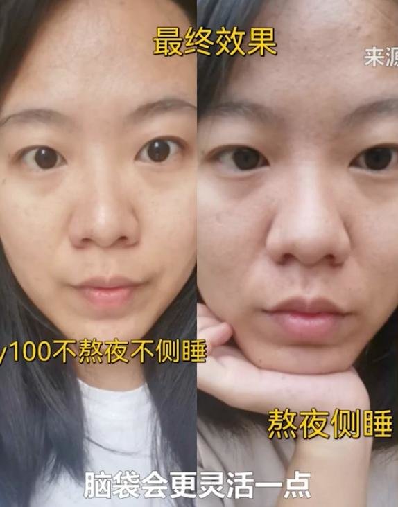 女子打卡286天坚持10点睡觉，变化惊人